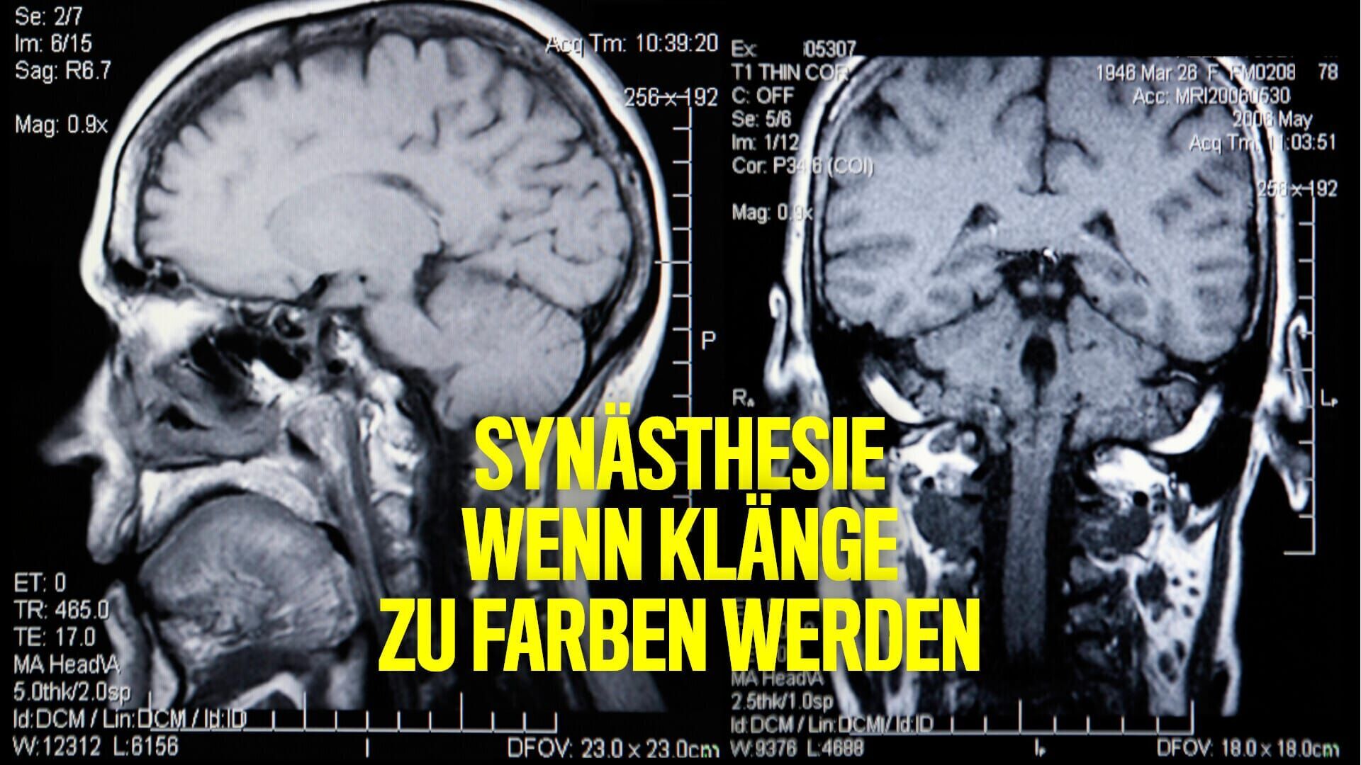 Synästhesie – Klänge und Farben