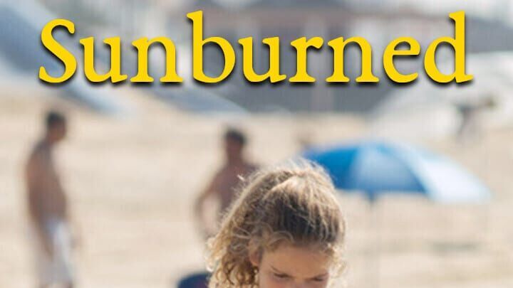 Sunburned