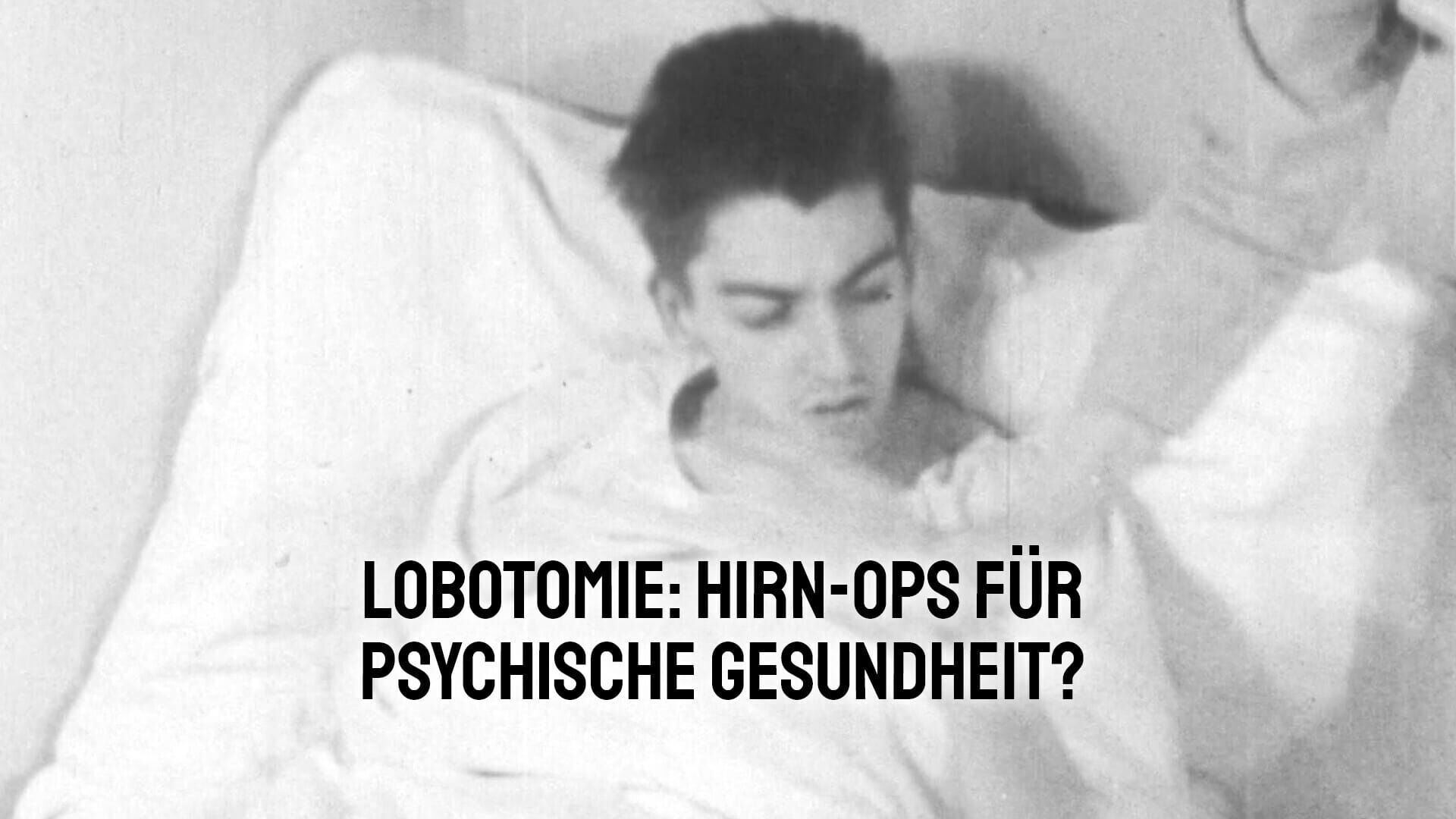 Lobotomie: Hirn-OPs für psychische Gesundheit?